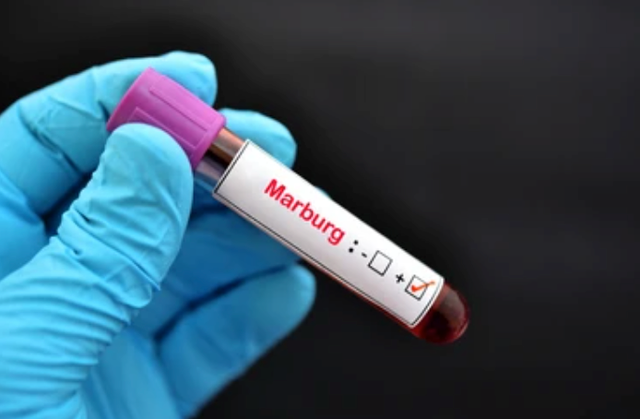 Virus Marburg lây truyền qua giọt bắn, gây tử vong đến 80% 