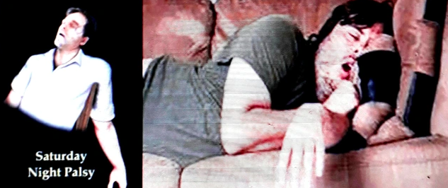 ‘Liệt tối thứ 7’ là hội chứng gì và tại sao gặp?