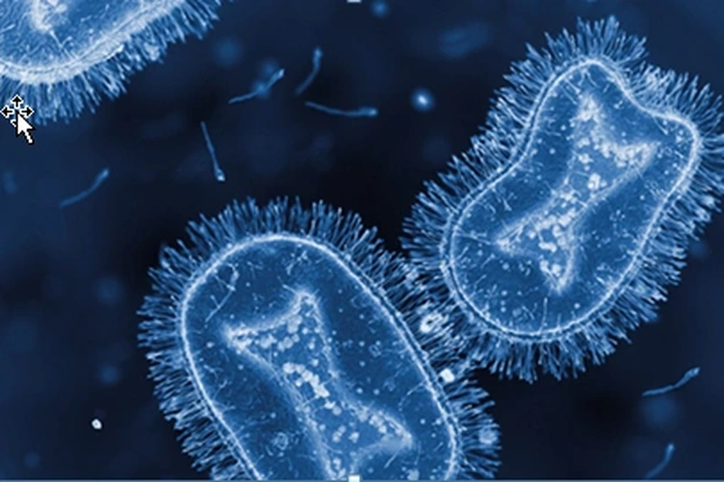 HIV và rủi ro đối mặt với bệnh đậu mùa khỉ: Điều bạn cần biết