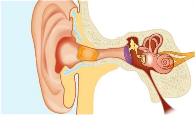Ngoáy tai thường xuyên, không đúng cách ảnh hưởng đến thính giác ra sao?