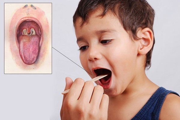 Vì sao bệnh bạch hầu xuất hiện ở nhiều tỉnh, thành?