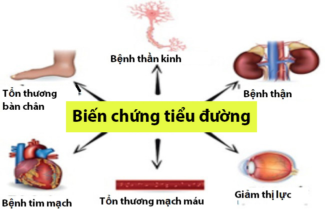 Số người bệnh đái tháo đường ở Việt Nam tăng nhanh