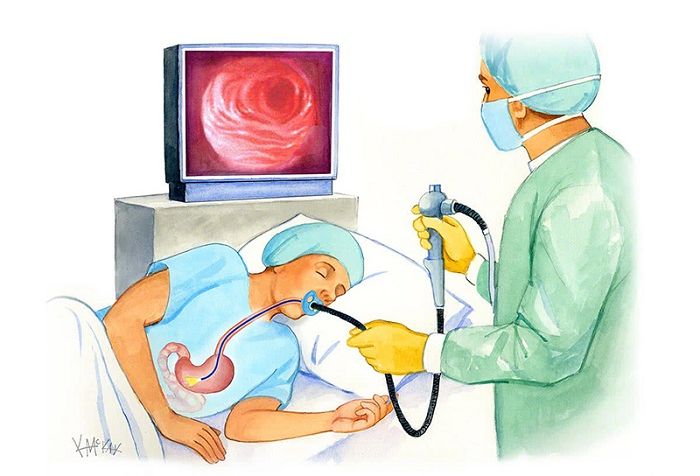 Alô, bác sĩ ơi! Tầm soát ung thư dạ dày tốn bao nhiêu tiền?