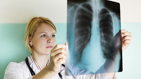 Coi chừng bệnh bụi phổi vì khó chữa hoặc không thể chữa khỏi