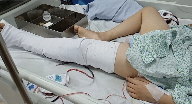 Cứu sống thành công bệnh nhi bị ung thư xương cánh tay