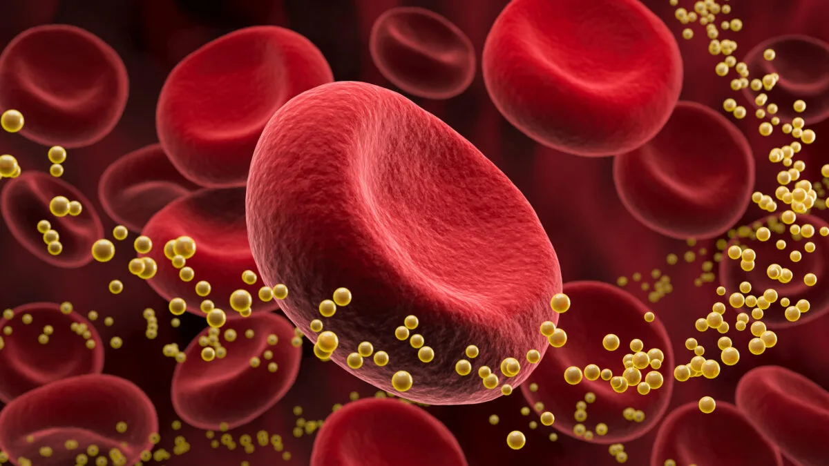 Mỡ máu – “Sát Thủ” Thầm Lặng Đối Với Sức Khỏe