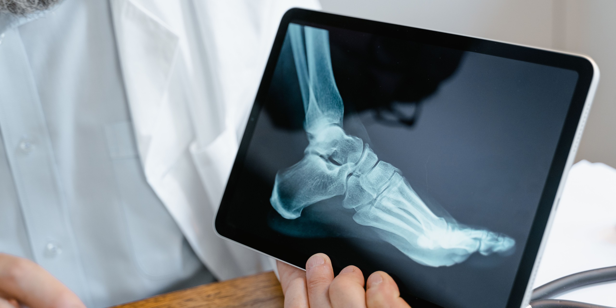 Chế độ ăn cho người bệnh ung thư xương