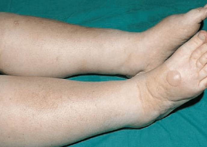 Người đàn ông trẻ vội vào viện cấp cứu vì trót cãi lời bác sĩ