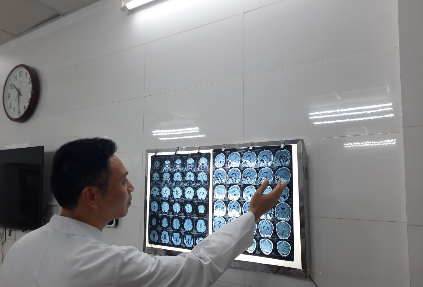 Não bộ tổn thương nặng nề của cựu chủ tịch xã món “đặc sản”