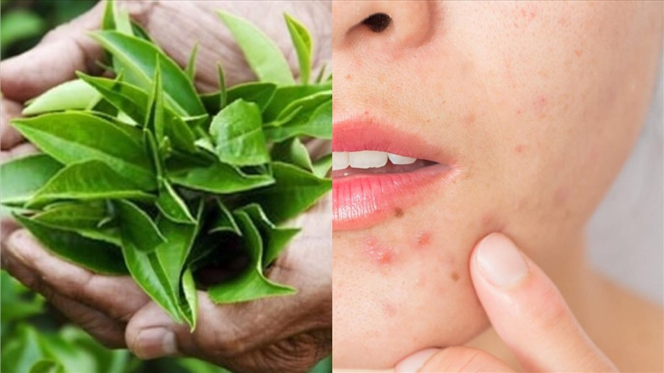 Vì sao trà xanh có tác dụng làm đẹp da?