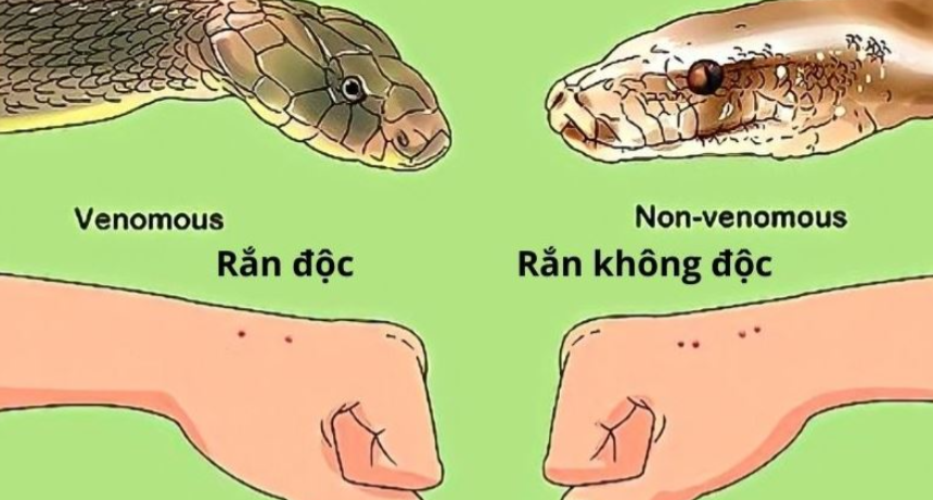 Bệnh viện Bạch Mai tiếp nhận nhiều ca bị rắn cắn trong bão Yagi