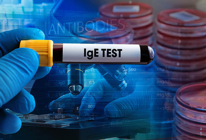 Nguyên nhân và cách xử lý sốc phản vệ