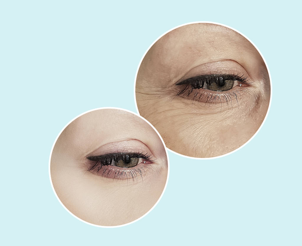 Thói quen cần từ bỏ để giảm thiểu nếp nhăn dưới mắt