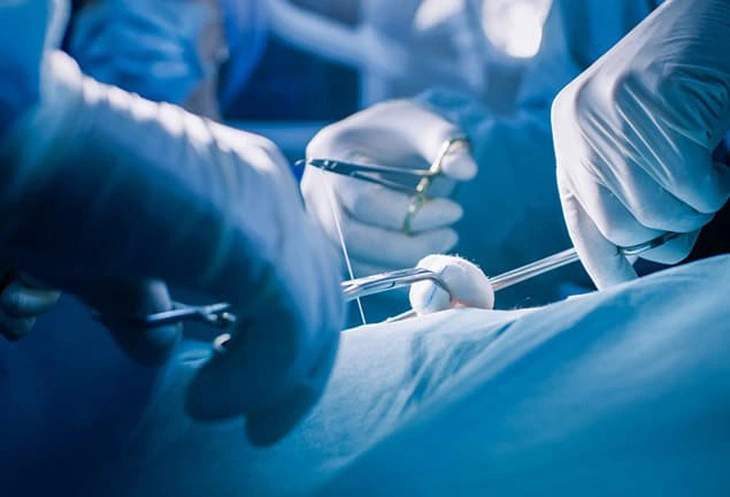 Cắt bao quy đầu: Những lưu ý quan trọng cho nam giới