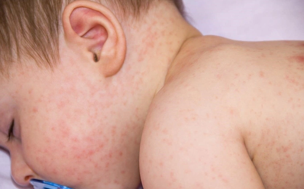 Tắm nước lá cho trẻ nhỏ là tốt? Liệu có còn đúng trong năm 2024