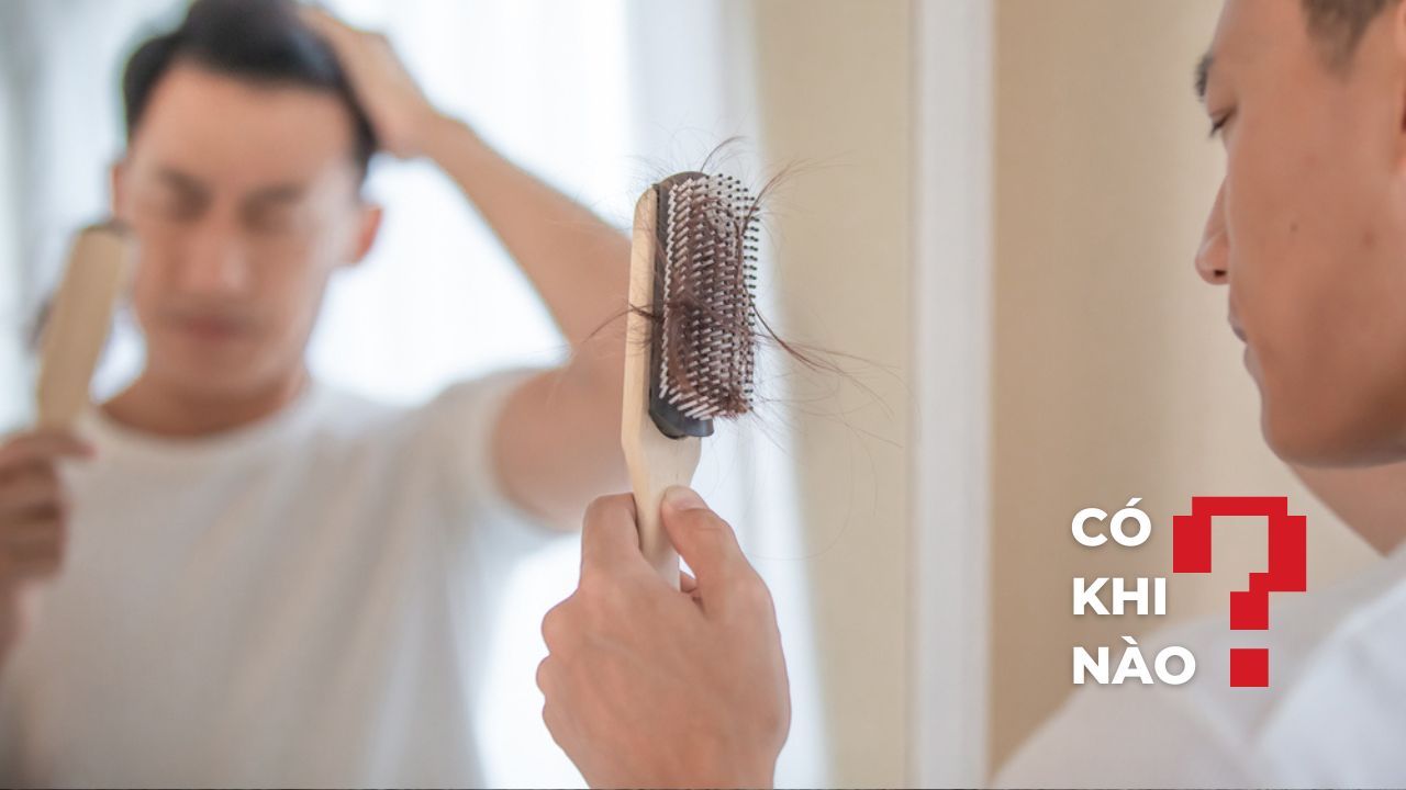 Có khi nào bổ sung testosterone cũng có thể gây rụng tóc