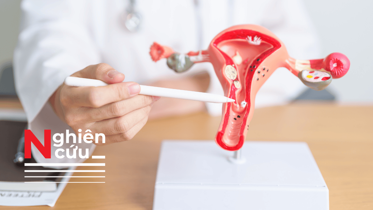 Phương pháp điều trị ung thư cổ tử cung mới giúp giảm nguy cơ tử vong