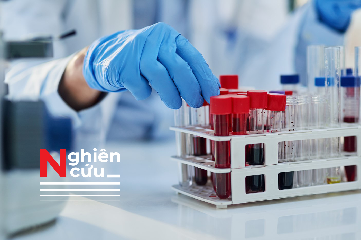 Nghiên cứu: Nhóm máu có mối liên hệ đến nguy cơ đột quỵ