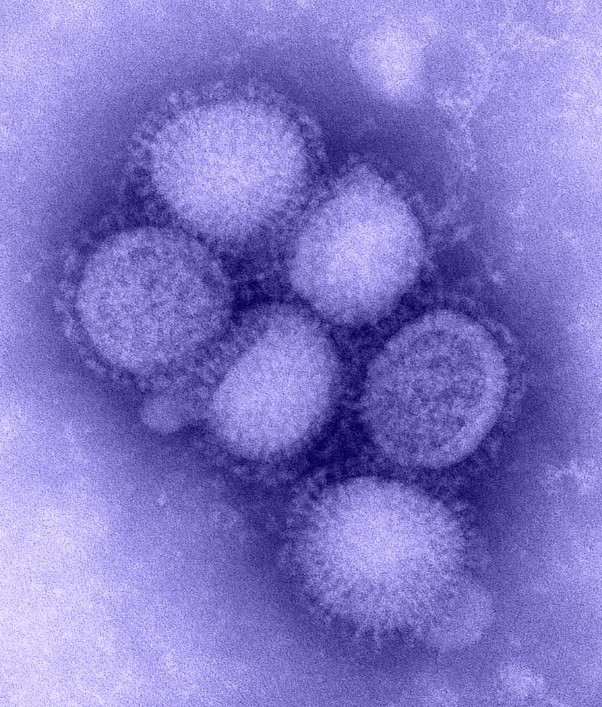 Bộ Y tế thông tin về virus A/H1pdm sau ca tử vong ở Bình Định