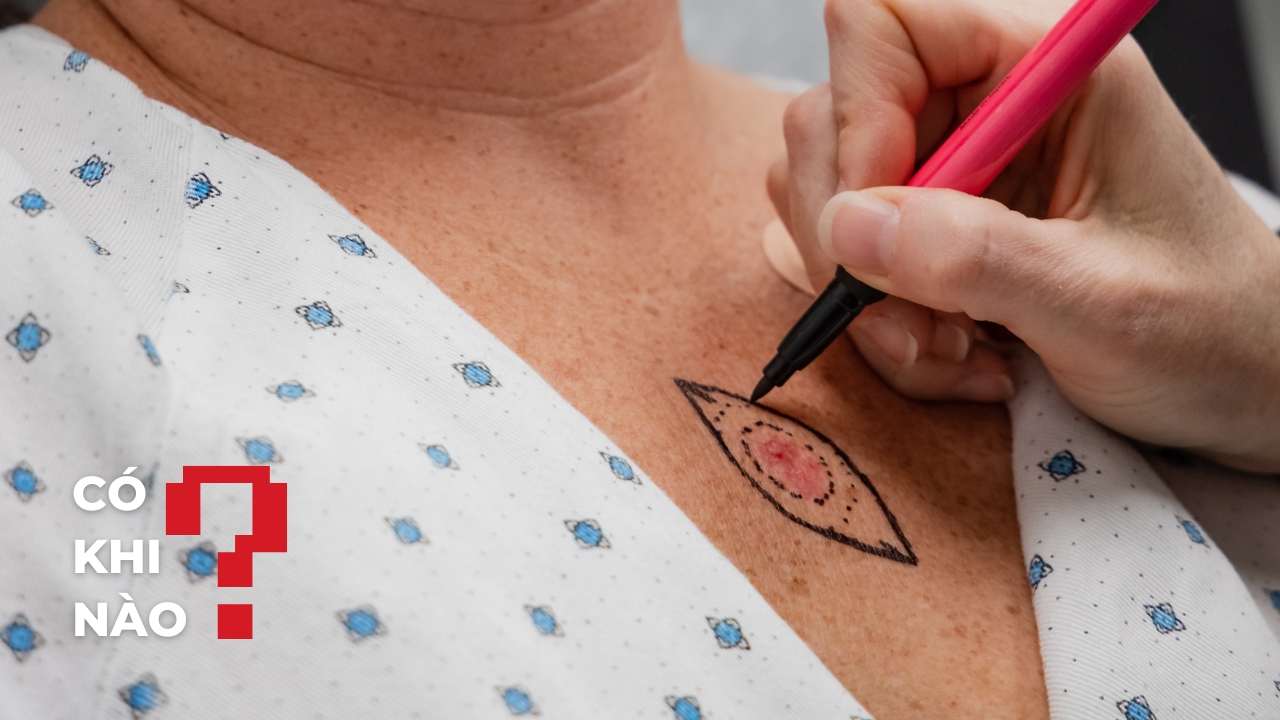 Có khi nào: Hình xăm cũng mang lời nhắc nhở bệnh tật?