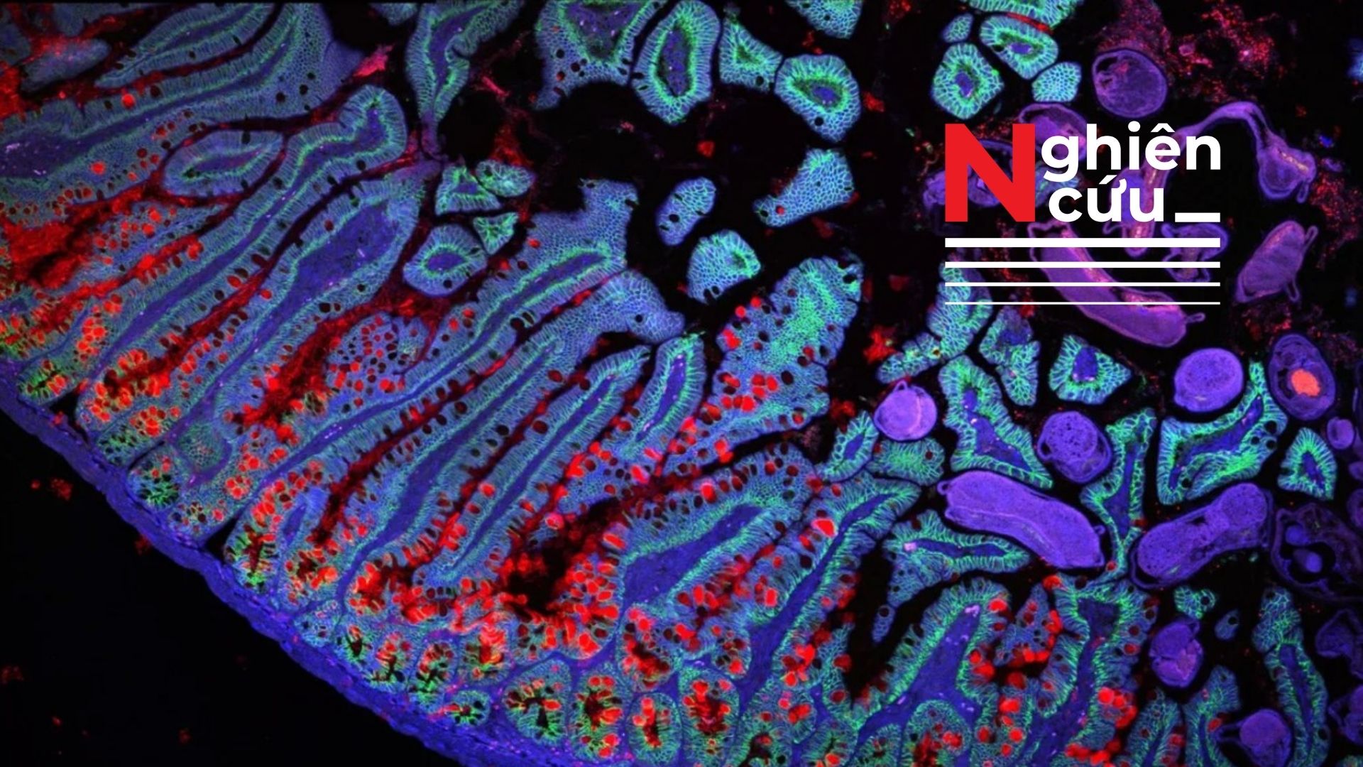 Dự án Bản đồ Tế bào Người (HCA) cách mạng hóa hiểu biết về bệnh tật