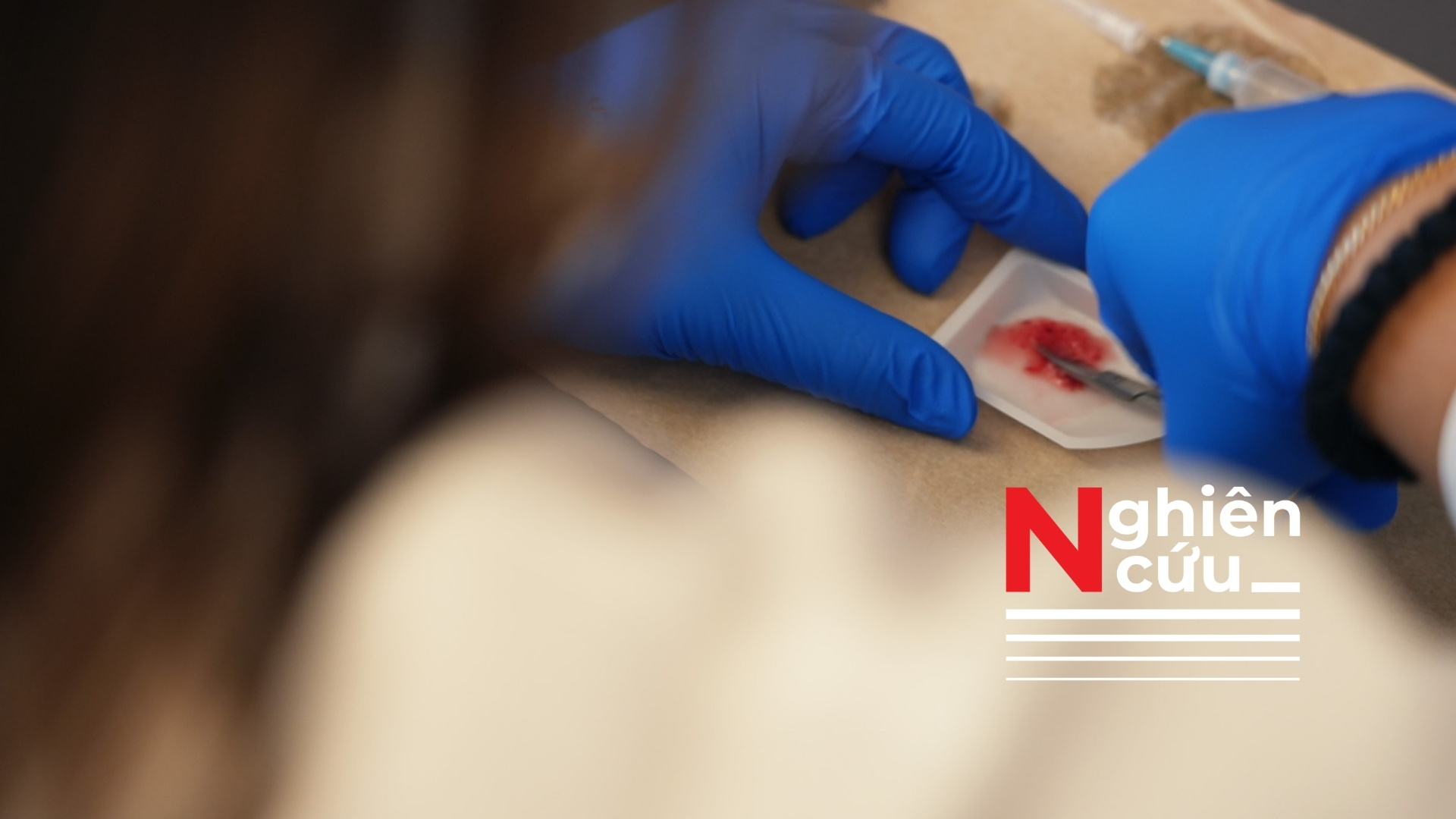 Độc đáo: Covid-19 làm kích hoạt cơ chế miễn dịch giúp thu nhỏ khối u ung thư