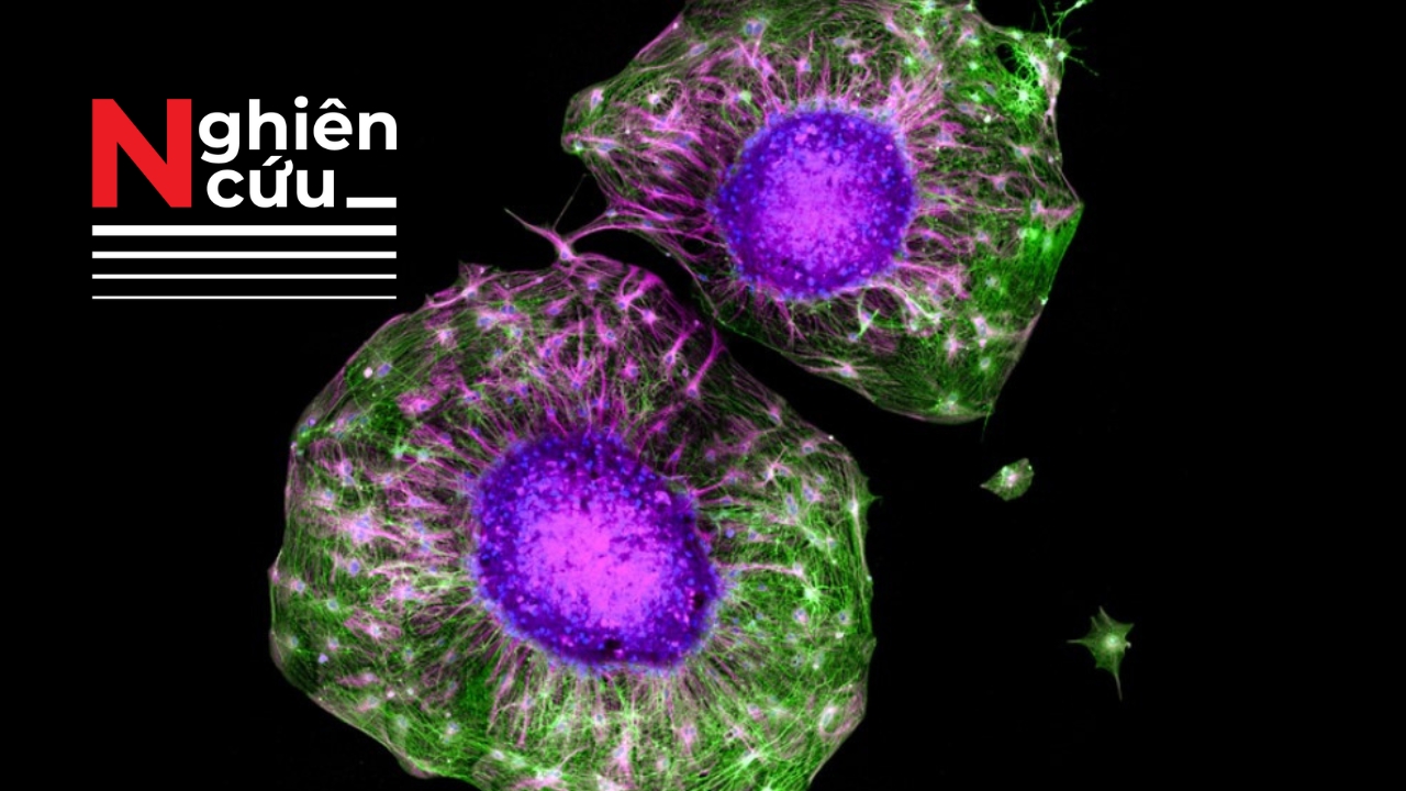 Nghiên cứu mới chỉ ra việc tập luyện cơ bắp giúp tế bào thần kinh phát triển