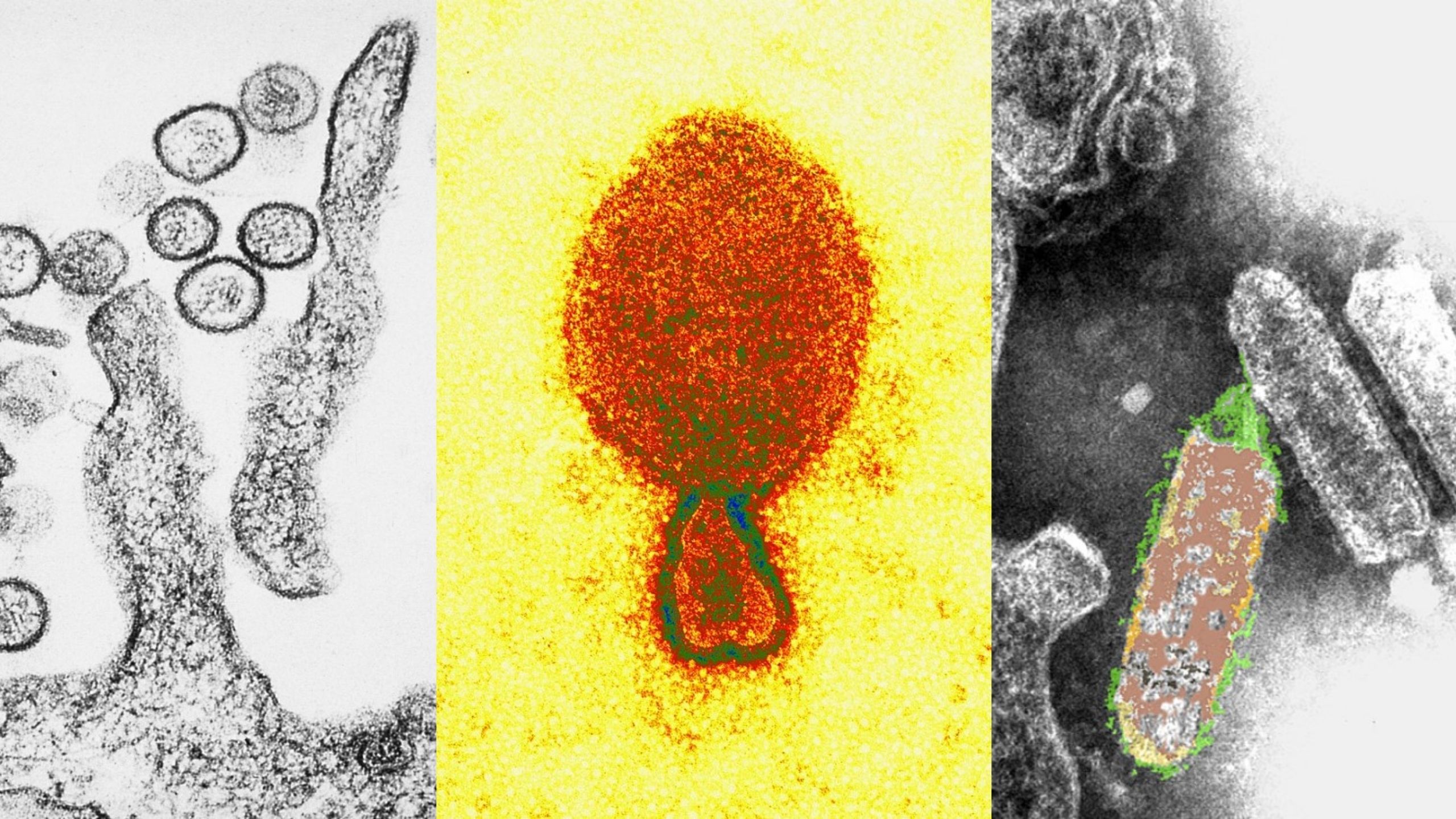 3 loại virus vừa bị “xổng” tại Úc nguy hiểm tới mức nào?