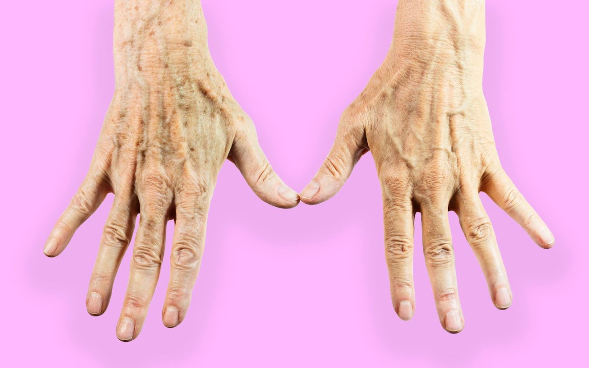 9 dấu hiệu “báo động” sức khỏe trên bàn tay