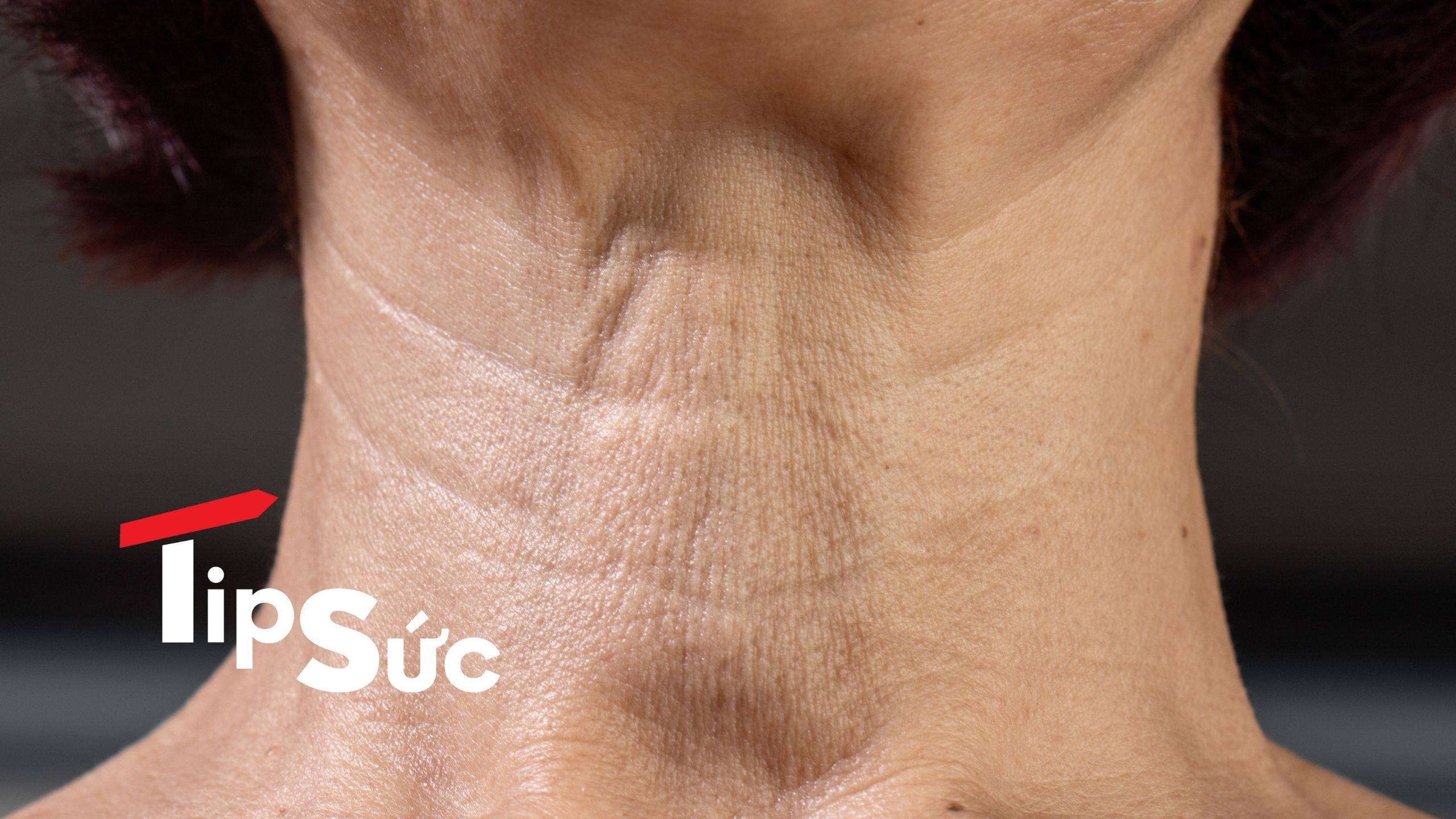 Cách chăm sóc cho vùng cổ bị lão hóa