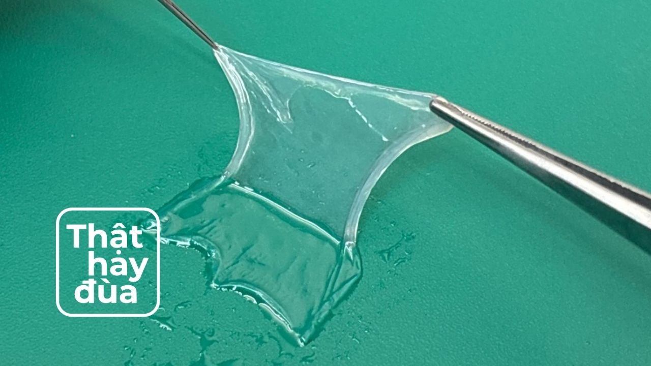 Thần kỳ: Dùng màng nhau thai phục hồi thị lực sau khi bị tạt axit