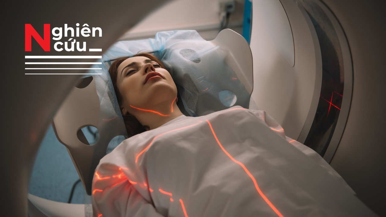 Số ca ung thư liên quan đến chụp CT tăng gấp 3 lần so với dự báo