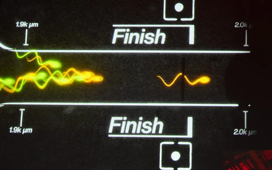 Độc lạ LA: Cuộc đua tinh trùng đầu tiên trên thế giới